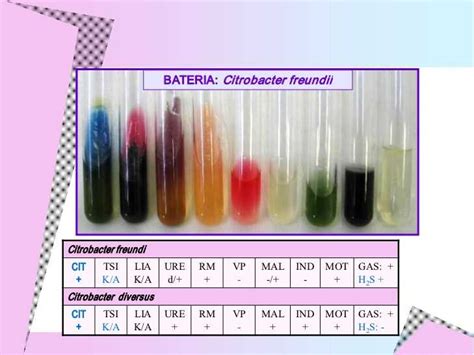 citrobacter freundii biochemical test results|Development and evaluation of a colorimetric LAMP.